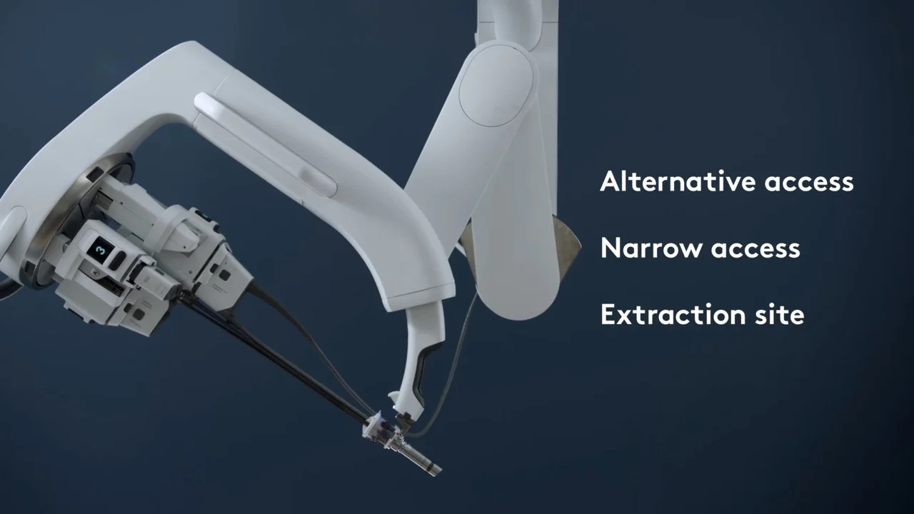 Da Vinci SP klinik uygulama alanları – alternatif erişim, dar alan cerrahisi