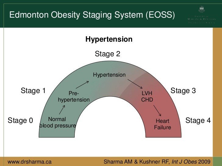 Hastaların Obezite Cerrahisine Uygunluğu Nasıl Değerlendirilir? 3